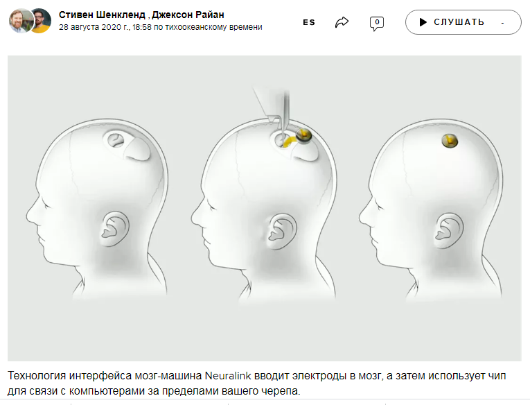 Подключения мозга к компьютеру имплант