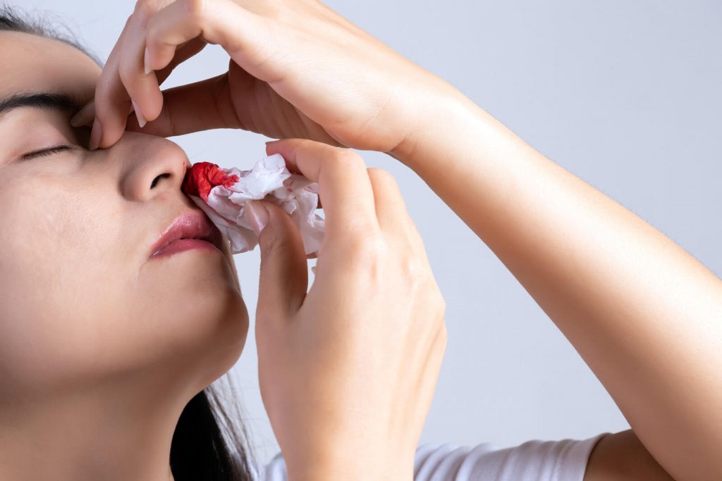 Носовое кровотечение: причины возникновения