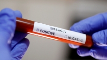В Грузии зафиксирован первый случай заражения коронавирусом