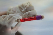 В Узбекистане обнаружен первый случай штамма коронавируса «омикрон»