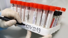 В России выявили штамм коронавируса «цербер»